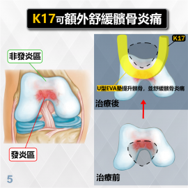 Medex K17 - Horseshoe-buttress Patello-Femoral Brace (Universal) 馬蹬式髕骨矯形護托