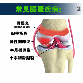 Medex K29 - Knee Wrap Support (Universal) 簡便膝部護托