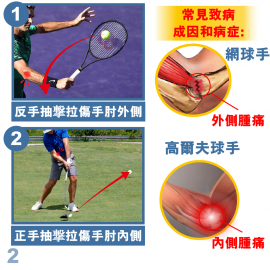 Medex E06b - Tennis Elbow Clasp (Universal) Cinch Device 手肘護托 (附微調拉繩器)