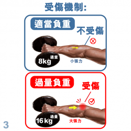 Medex E06b - Tennis Elbow Clasp (Universal) Cinch Device 手肘護托 (附微調拉繩器)