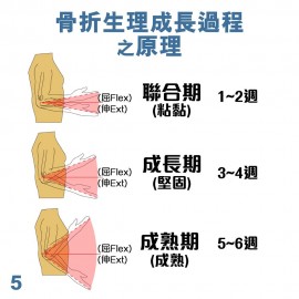 Medex E13b - Elbow Rom Brace Deluxe (Universal) (L/R) 肘限位固定護托