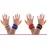WristWidget TFCC 三角纖維軟骨複合體損傷護手腕帶