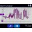 NeuroTrac MYOPLUS PRO EMG - NeuroTrac MYOPLUS 高級EMG設備