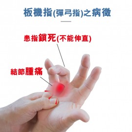 Medex H15b - Trigger Finger Splint (with cinch device) 夜用板機指矯形護托(附微調拉繩器)