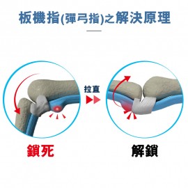 Medex H15b - Trigger Finger Splint (with cinch device) 夜用板機指矯形護托(附微調拉繩器)