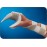 Preformed Functional Position Hand Splint - 預製功能性手固定夾板