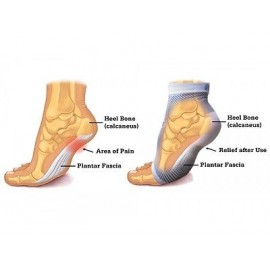 OS1st FS6 Compression Foot Sleeve (Pairs) / Plantar Fasciitis Sleeve - 美國壓力襪FS6足部6段壓踝套 / 足底筋膜炎脚套