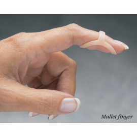 The Original 3-Point Oval-8 Trigger Finger Splint - Oval-8®手指夾板