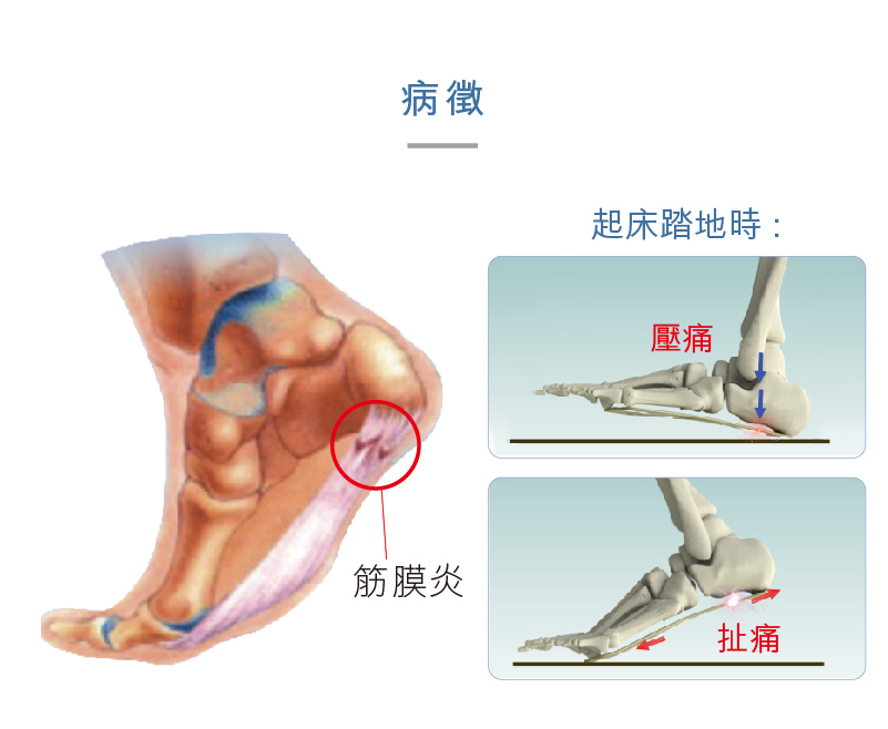 Medex F02 - Silicone Heel Cushion (Pair) 矽膠腳後跟鞋墊 - Fu Kang Online Store